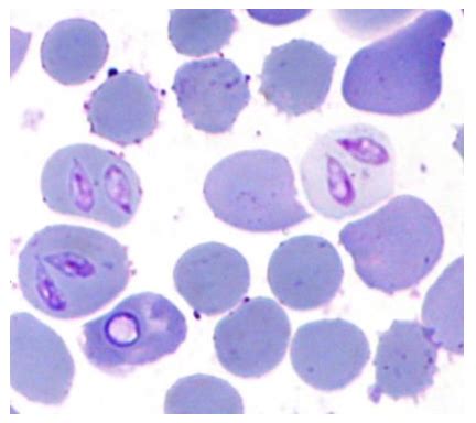  Babesia! A Tiny Terror Lurking in the Bloodstream of its Mammalian Hosts